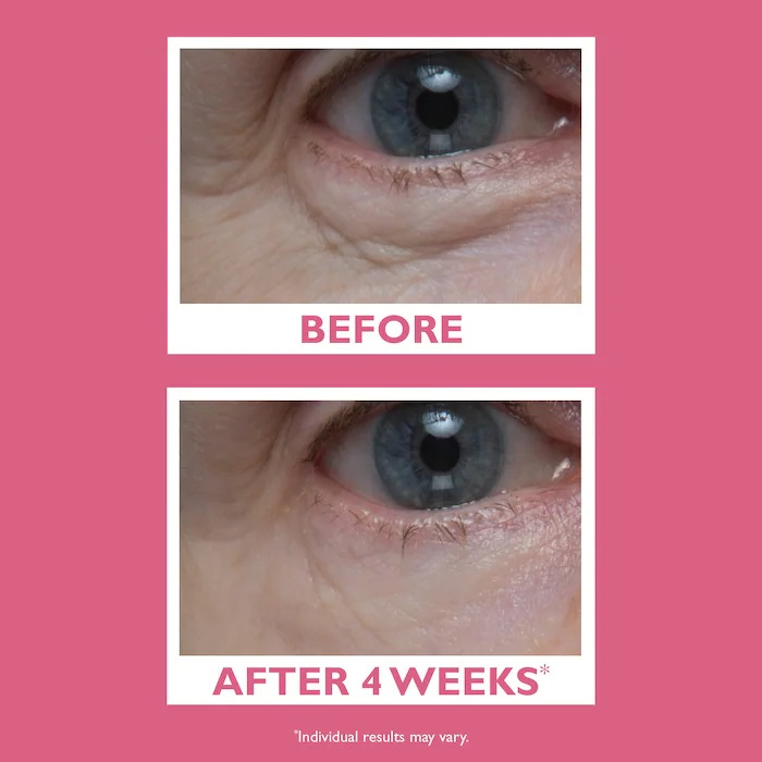 Crema pentru ochi VITAL-E Microbiome Age Defense Eye Cream, 15 ml [4]
