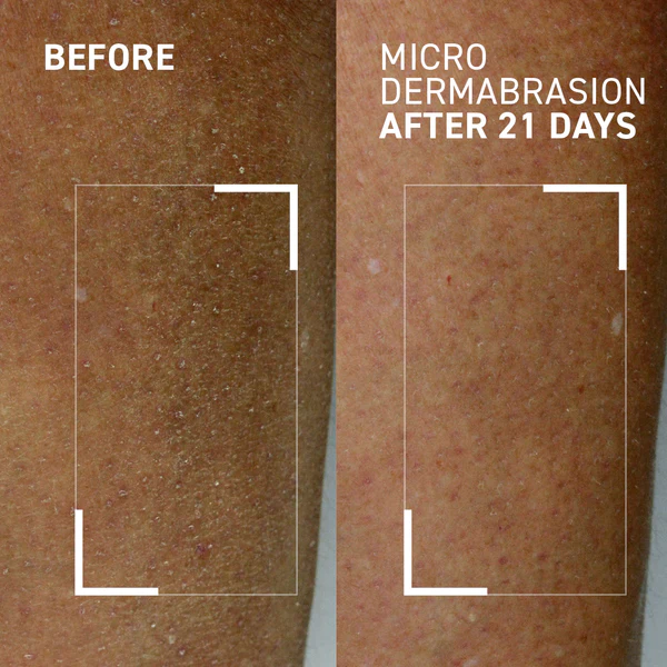 Exfoliant hidratant pentru corp Microdermabrasion Body Polishing Exfoliator, 125 ml, Dr. Brandt [2]