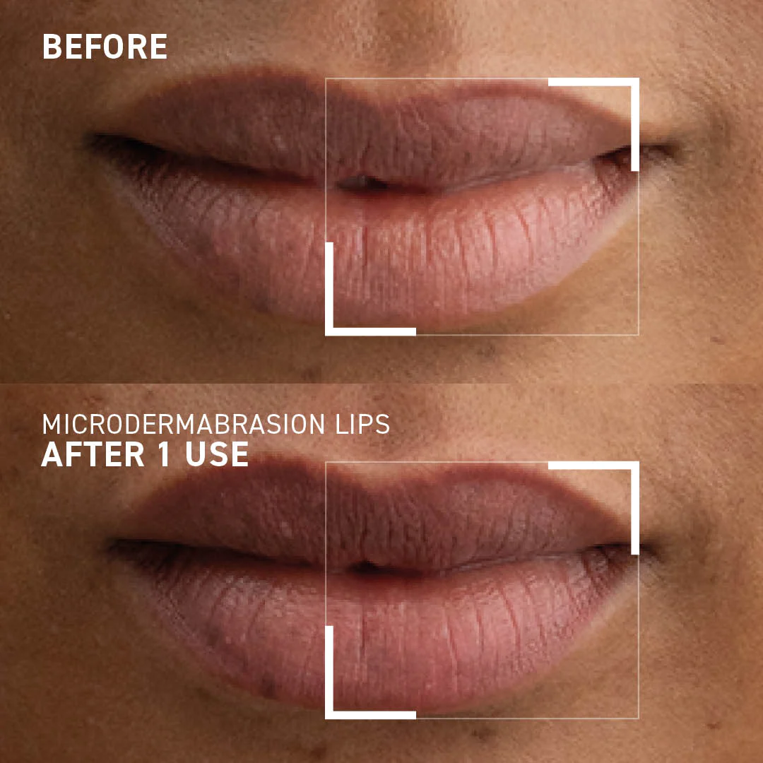 Exfoliant pentru buze Microdermabrasion Smoothing Lip Scrub, 10 ml, Dr. Brandt [7]