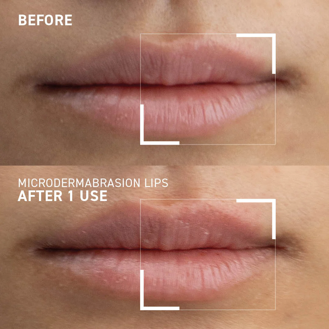 Exfoliant pentru buze Microdermabrasion Smoothing Lip Scrub, 10 ml, Dr. Brandt [6]