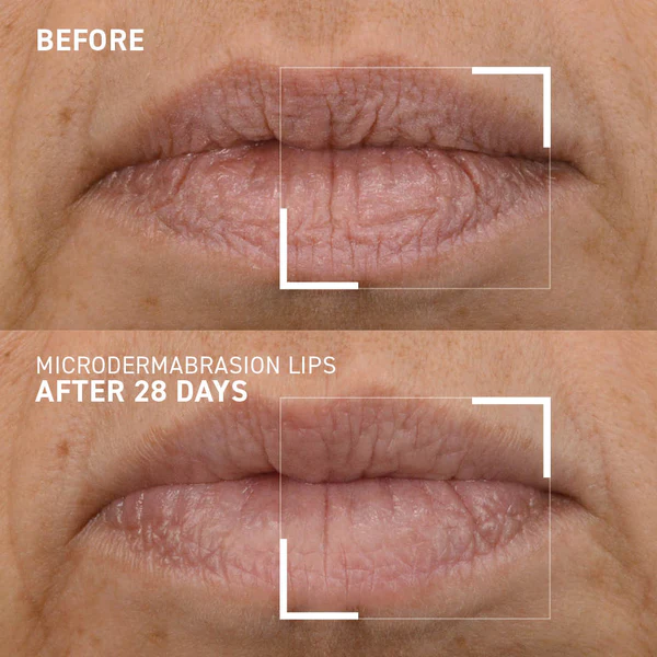 Exfoliant pentru buze Microdermabrasion Smoothing Lip Scrub, 10 ml, Dr. Brandt [4]