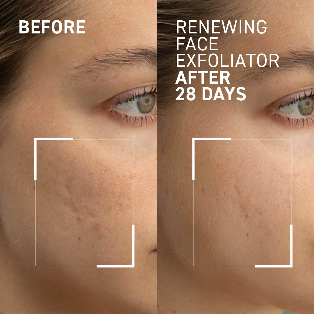 Exfoliant pentru fata Microdermabrasion Renewing Face Exfoliator, 60 ml, Dr. Brandt [3]
