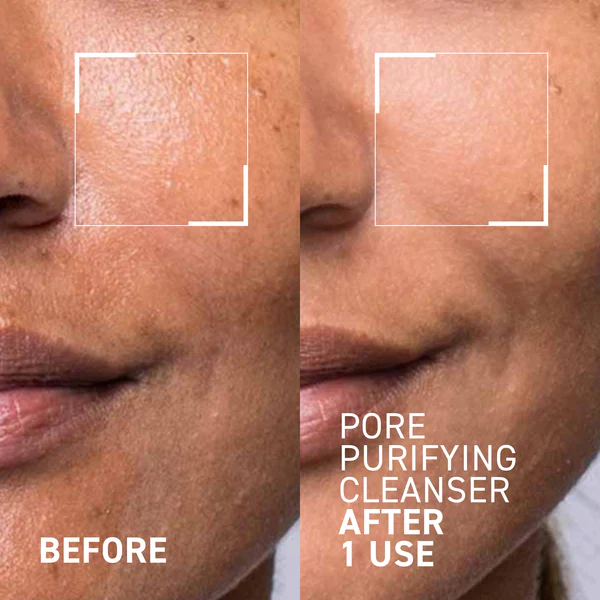 Gel pentru curatarea fetei Pores No More Pore Purifying Cleanser, 105 ml, Dr. Brandt [3]
