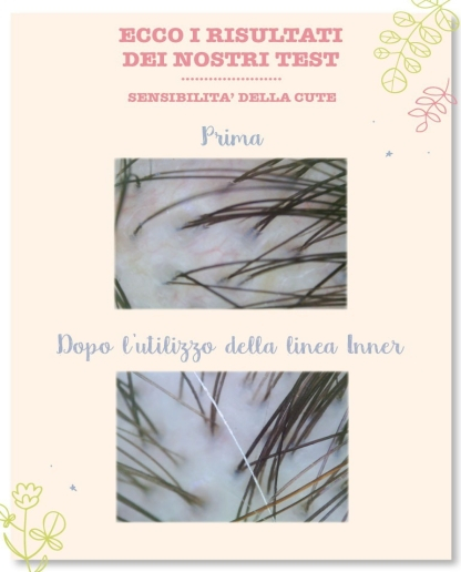 Lotiune hidratanta si calmanta pentru scalp, 10 X 5 ml [4]