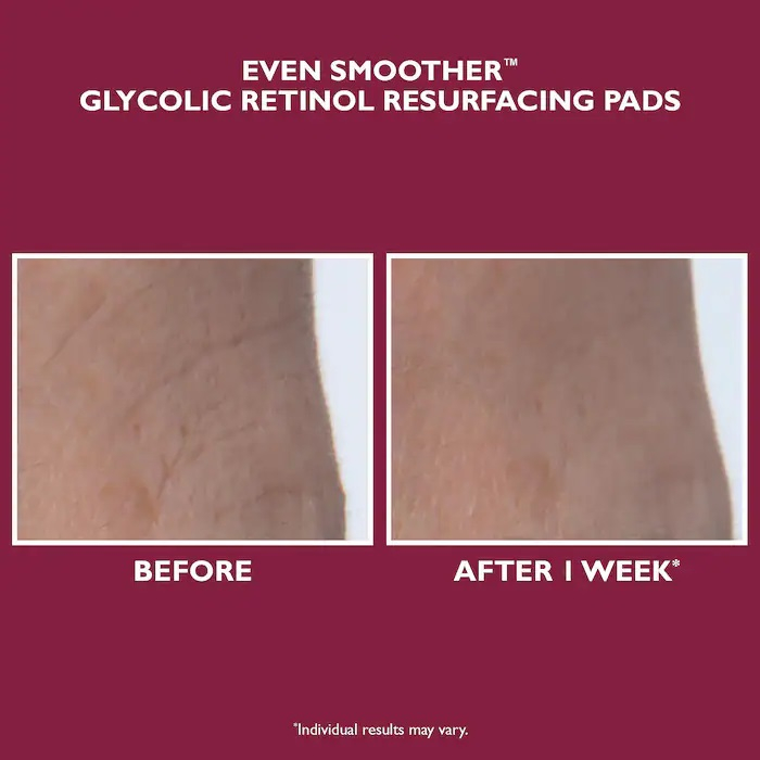 Patchuri EVEN SMOOTHER™ Glycolic Retinol Resurfacing Peel Pads, 60 bucati [7]