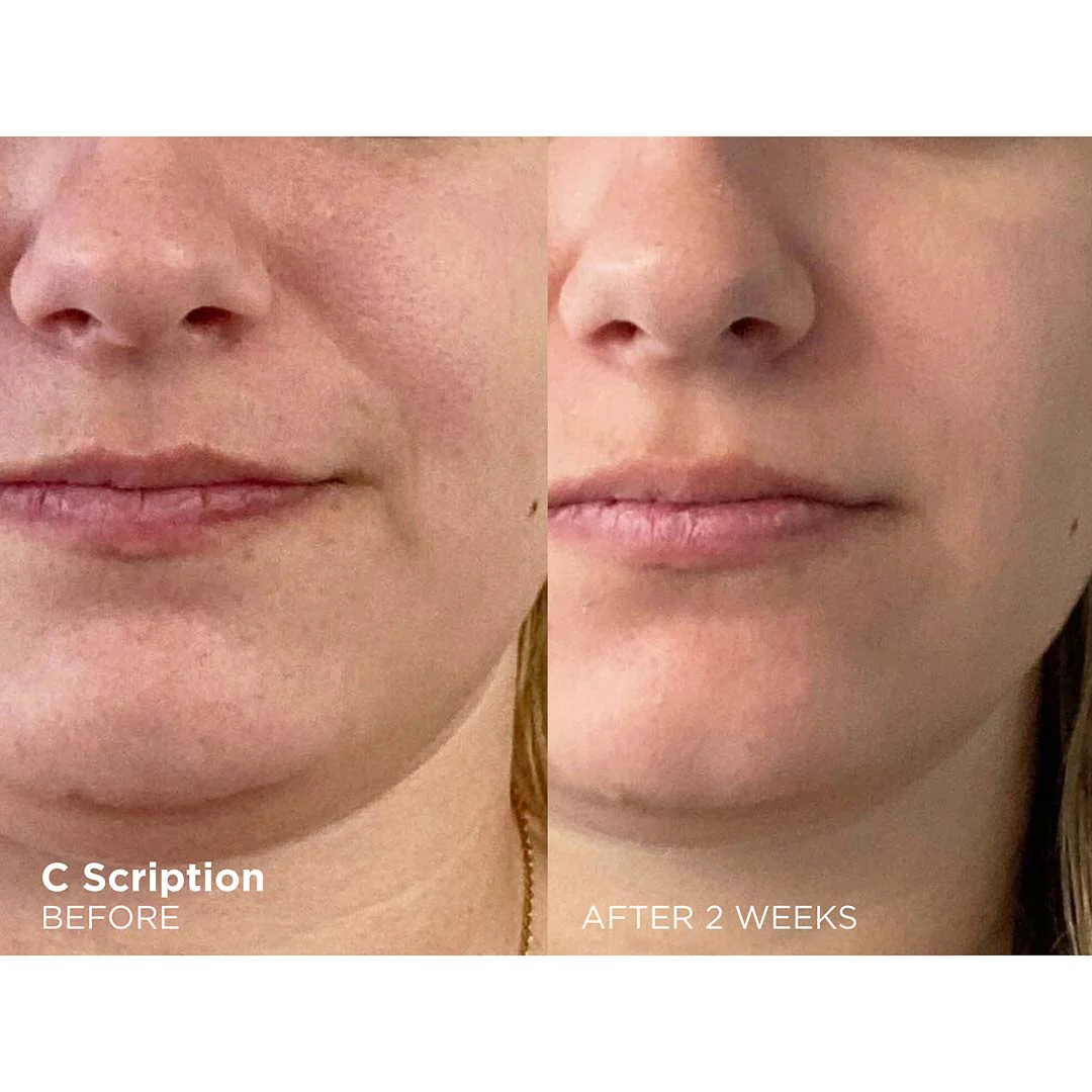 Serum de fata ultraconcentrat cu Vitamina C Bright This Way C Scription, 30 ml, Dr. Brandt [3]