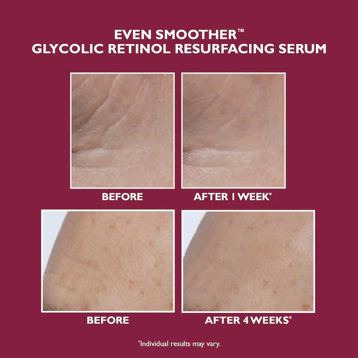 Serum EVEN SMOOTHER™ Glycolic Retinol Resurfacing Serum, 30 ml [7]
