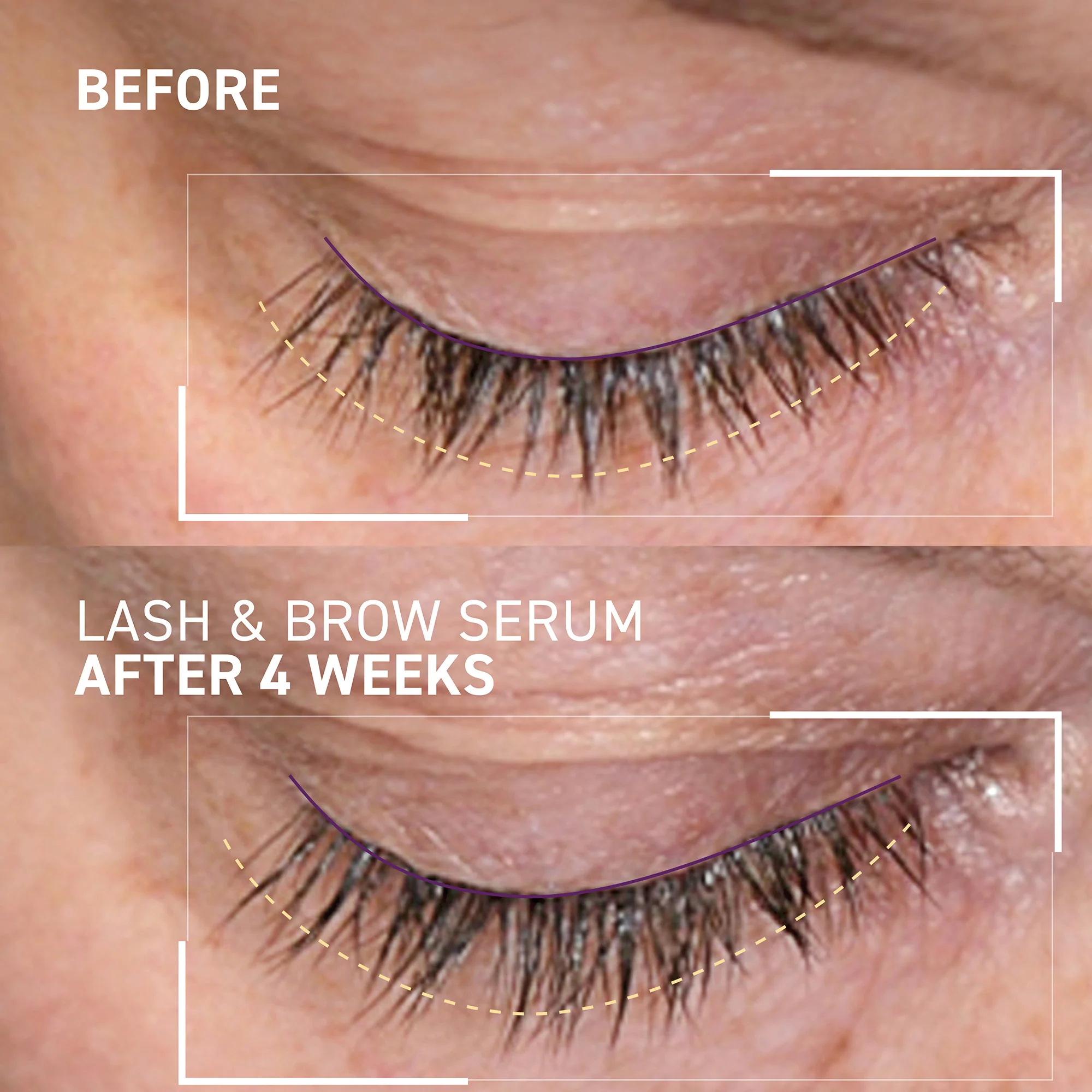 Serum pentru gene si sprancene Dr. B. Lab. Lash and Brow Serum , 5 ml, Dr. Brandt [3]
