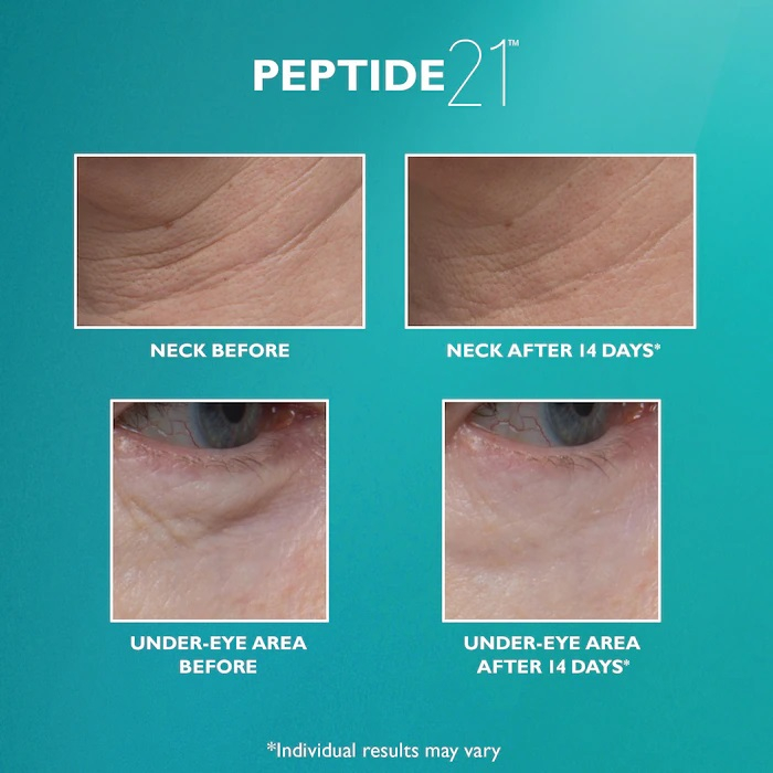 Serum Peptide 21™ Wrinkle Resist Serum, 30 ml [6]
