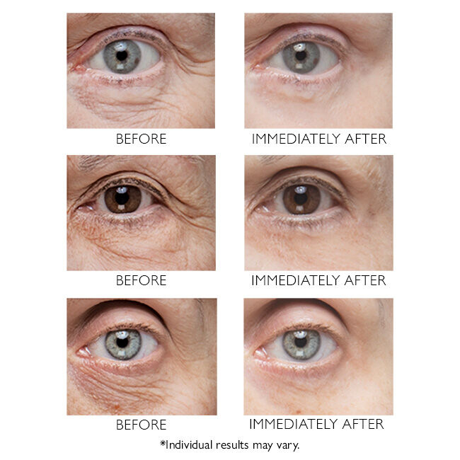 Tratament pentru ochi  Instant FIRMx® Eye, 30 ml [4]