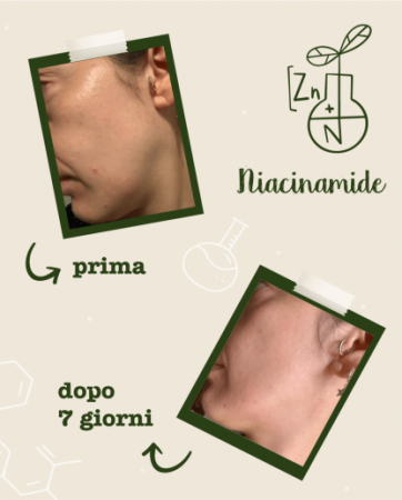 Activ pur cu Niacinamide si Zinc, 30 ml [3]