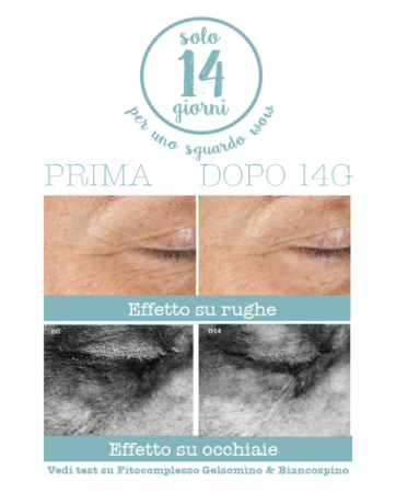 Crema pentru conturul ochilor 3 in 1 , 15 ml [2]