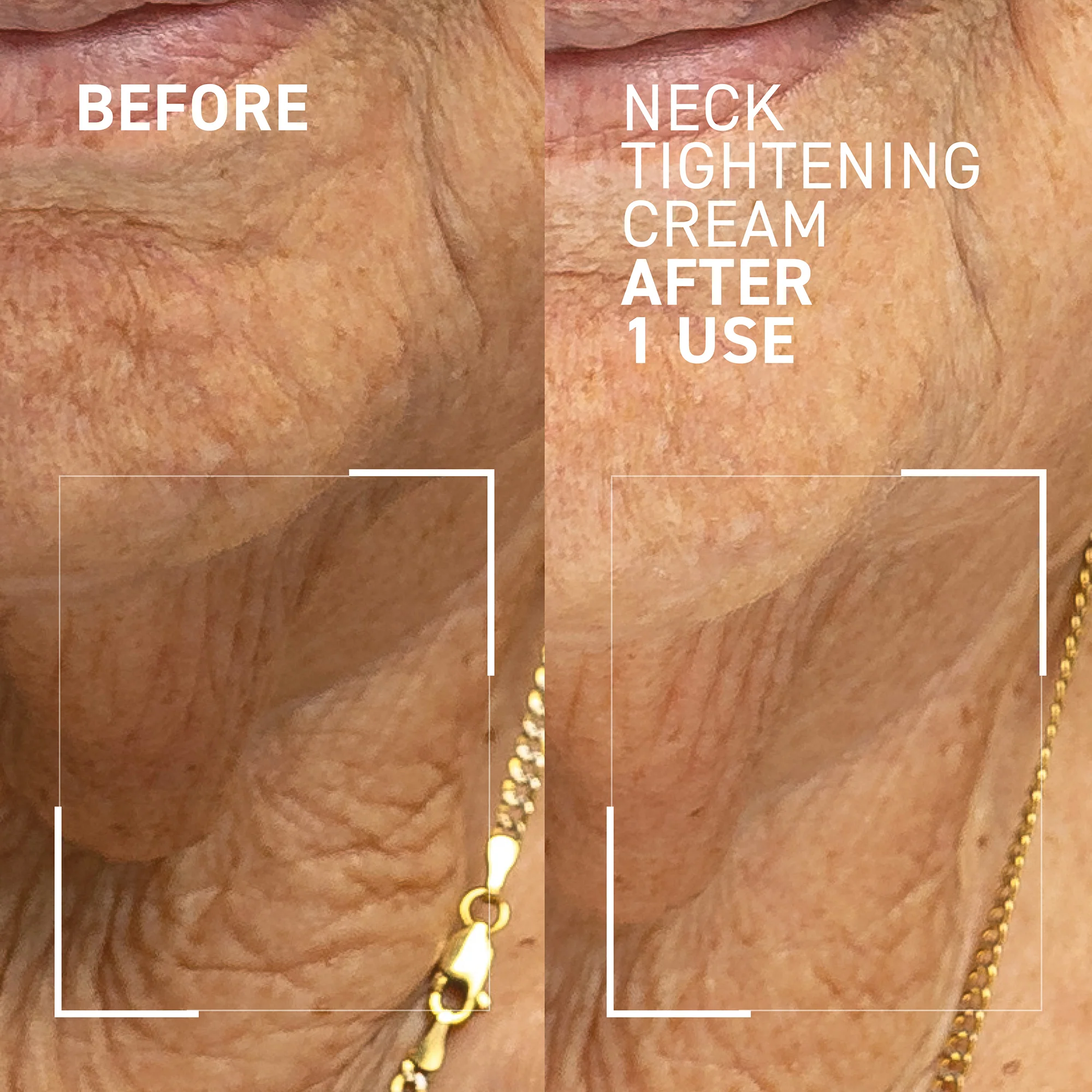 Crema pentru gat Needles No More Neck Sculpting Cream, 50 ml, Dr. Brandt [1]