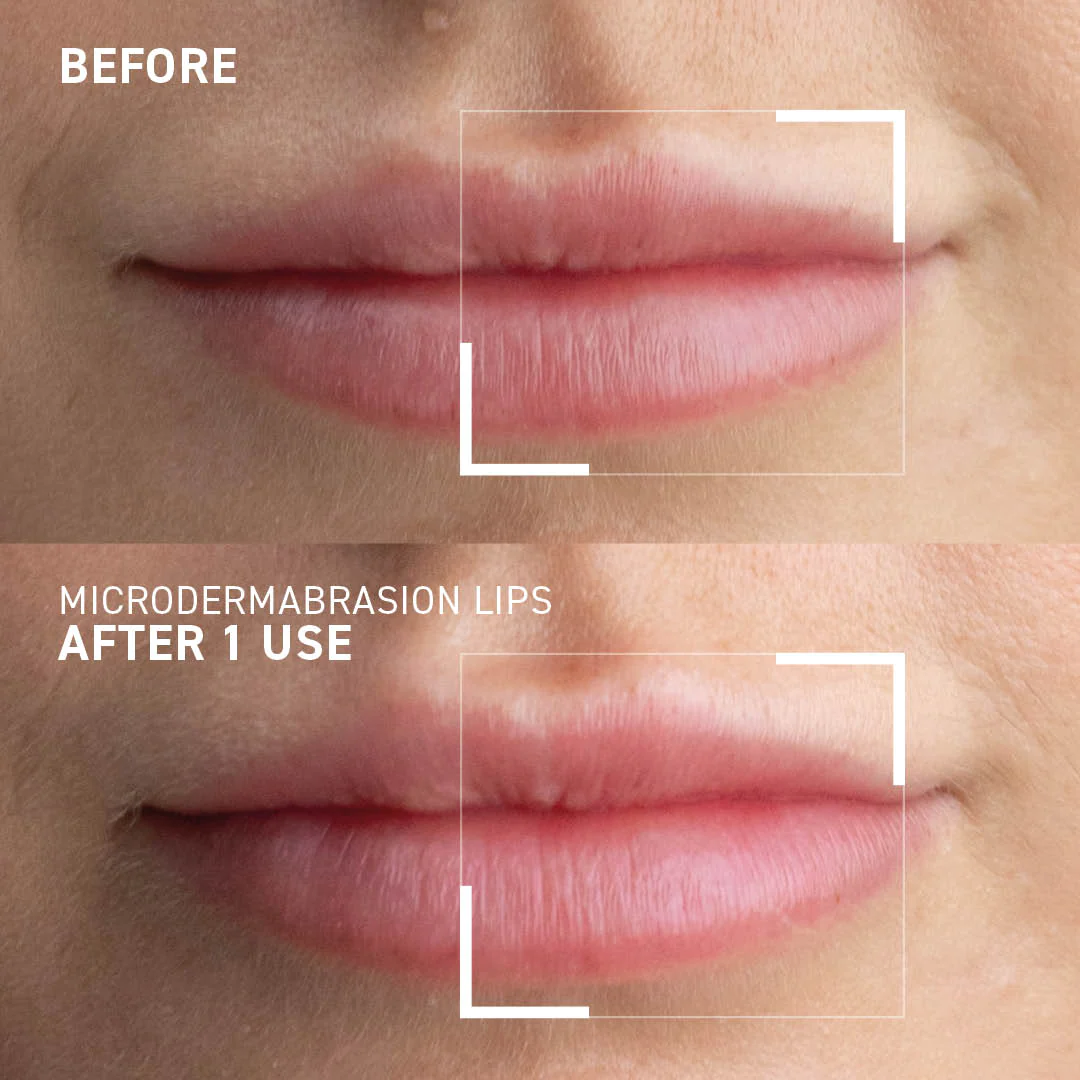 Exfoliant pentru buze Microdermabrasion Smoothing Lip Scrub, 10 ml, Dr. Brandt [1]