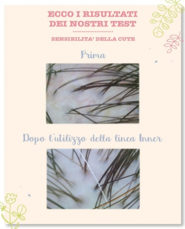 Lotiune hidratanta si calmanta pentru scalp, 10 X 5 ml [3]