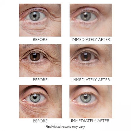 Tratament pentru ochi  Instant FIRMx® Eye, 30 ml [3]