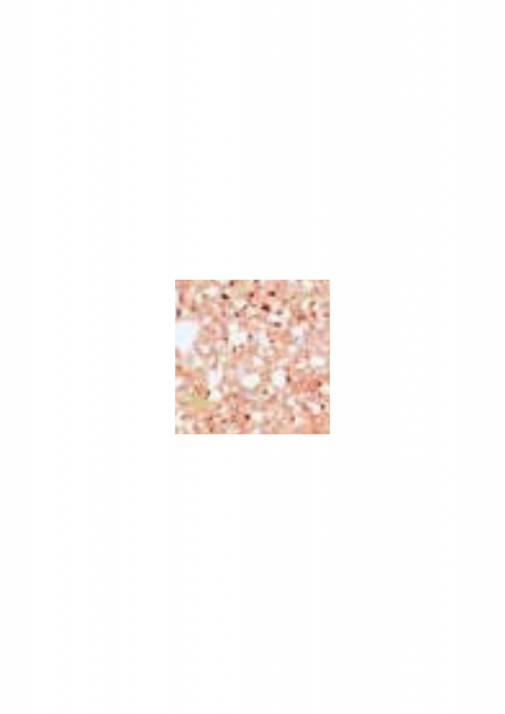 Capac gard  decorativ din beton - 25cm [2]