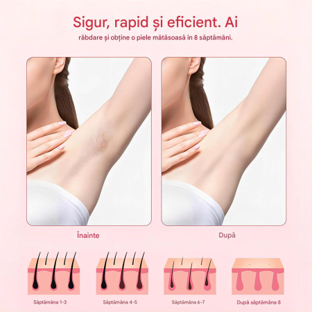 Epilator IPL OIAO E69-HR009, Pentru Epilare Definitiva Fara Durere, Tehnologie IPL, 5 Trepte De Intensitate, Senzor Piele SmartSkin, Mod Automat, Cu Afisaj, 990.000 de Pulsati [3]