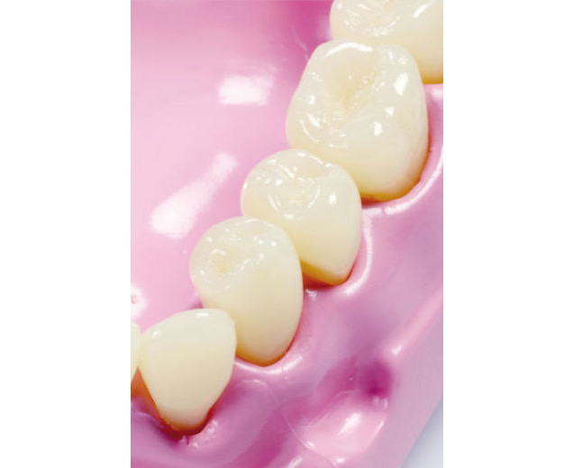 Set dentar demonstrativ, 9 x 11 x 19 cm [3]
