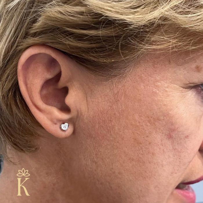 Cercei-aur-alb-cu-protectie-Kalini-Inimi-cu-zirconia-centrata [4]