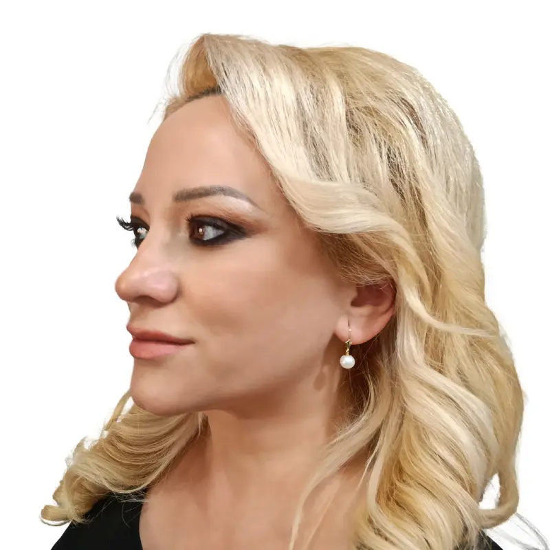 nausnice-biele-prirodne-perly-8mm-okruhle-aaa-zlato-14k-tulipan-kaskadda [4]