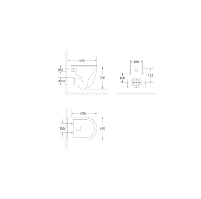 Set Vas WC suspendat Rimless si Capac SoftClose Gold [4]