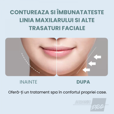 Aparat Facial AcronicPro Portabil, Ingrijirea Pielii, Frumusete si Sanatate, Pentru Indepartarea Ridurilor si a Petelor, Albastru [7]