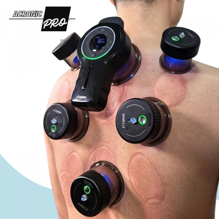 Aparat Vacuum AcronicPro, Set 6 Ventuze, Multifunctional, Cupe Electrice Inteligente pentru Terapie, Relaxare si Tonifiere, Acumulator, Negru [2]