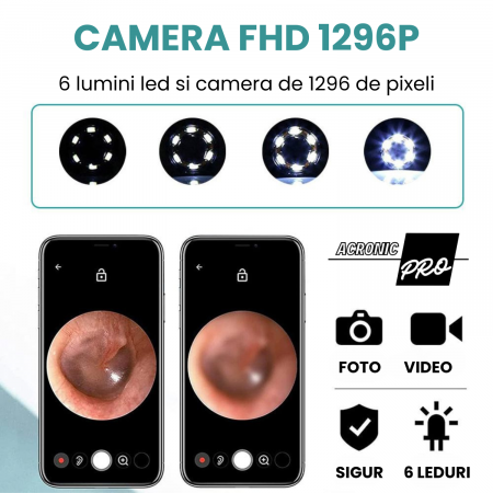 Dispozitiv Inteligent AcronicPro® pentru Curatarea Urechilor, Cu Camera si LED, Dispozitiv Wireless, Type-C, Negru [3]