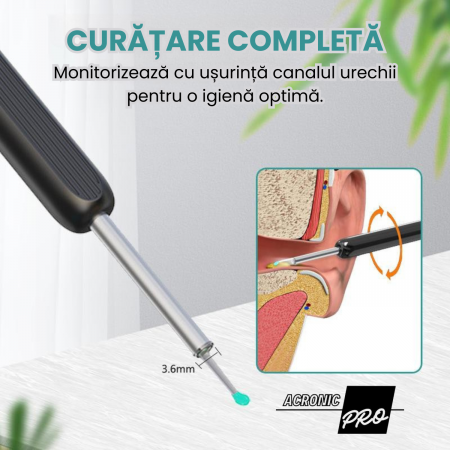 Dispozitiv Inteligent AcronicPro® pentru Curatarea Urechilor, Cu Camera si LED, Dispozitiv Wireless, Type-C, Negru [4]