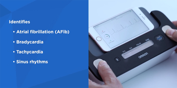 Omron Complete - Tensiometru automat pentru brat + EKG / ECG (electrocardiograma), validat clinic, functie AFIB, fabricat in Japonia [11]