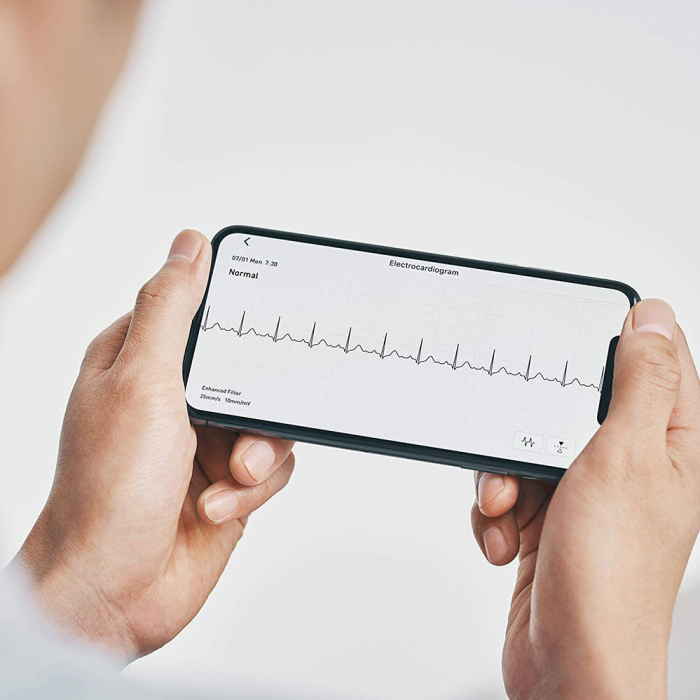 Omron Complete - Tensiometru automat pentru brat + EKG / ECG (electrocardiograma), validat clinic, functie AFIB, fabricat in Japonia [5]