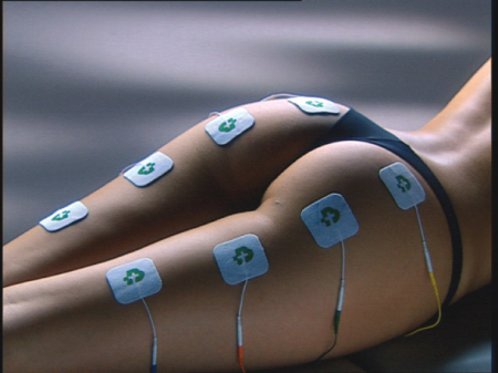Set paduri Electrostimulator Tesmed Max 5 - 4 bucati 50 x 50 mm, compatibili cu Medisana TDP [1]