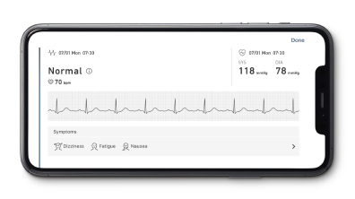 Omron Complete - Tensiometru automat pentru brat + EKG / ECG (electrocardiograma), validat clinic, functie AFIB, fabricat in Japonia [9]