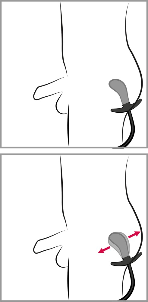 Anal You2Toys Inflatable Plug [10]