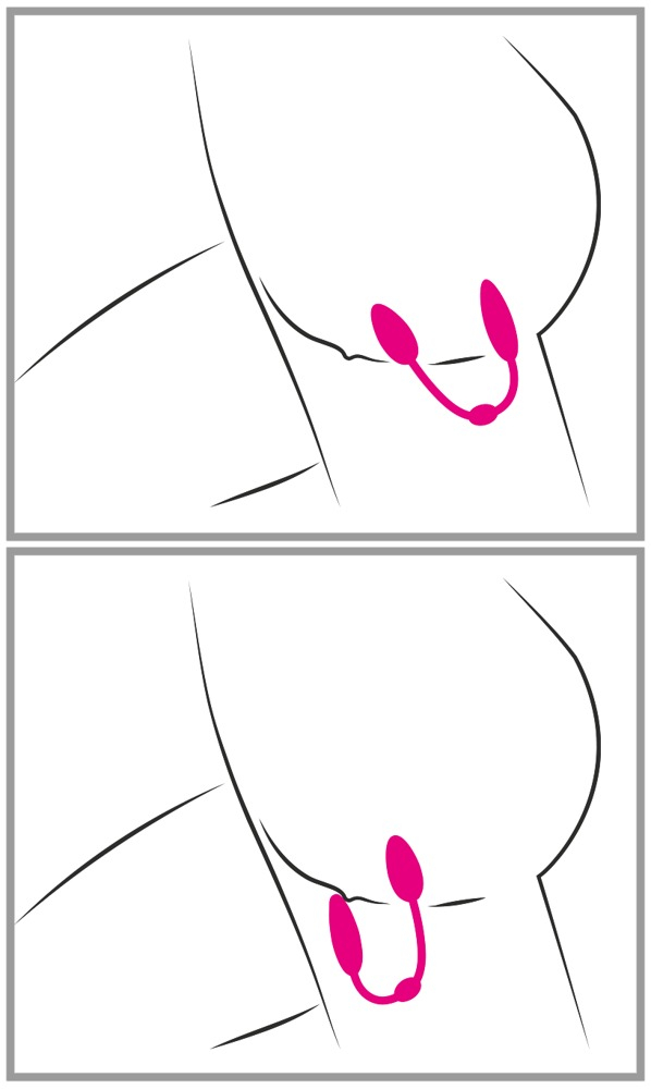 Bile Vaginale Kegel Femei Intarire Muschi Pelvini Sweet Smile RC Double Pleasure Love Balls [14]