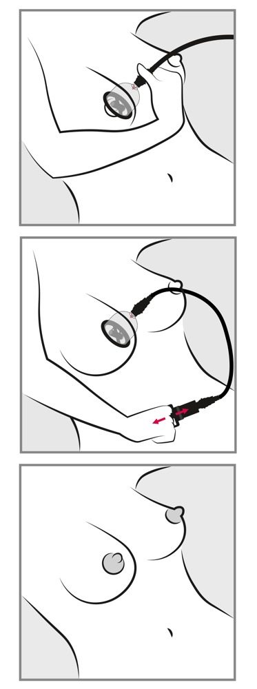 Cupe Aspiratie Sani Bad Kitty Vibrating Nipple Cups [7]