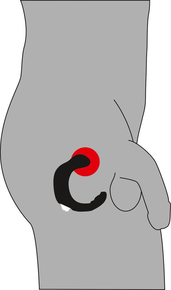 Vibrator Rebel Prostate Stimulator [8]