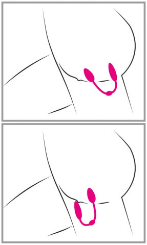 Bile Vaginale Kegel Femei Intarire Muschi Pelvini Sweet Smile RC Double Pleasure Love Balls [13]