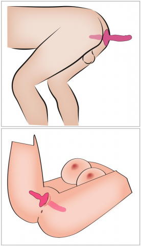 Vibrator Cuplu Couples Choice 2in1 Vibrator Butt Plug [10]