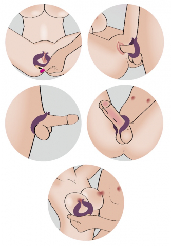 Inel Vibrator Penis Couples Choice Two Motors Couple’s Ring [8]