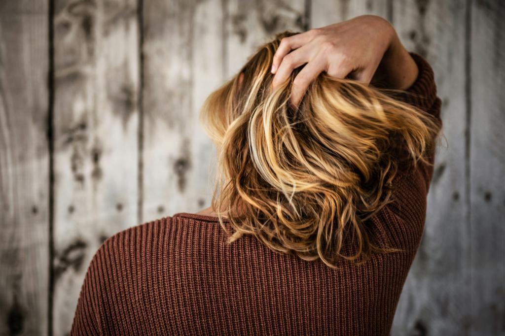 Tratamentul și prevenția dermatitei seboreice la scalp - cum scăpăm de eczeme, coji și scuame