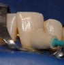 Intensiv Unigloss Polisher Cupă (set cu 6 bucăți) [1]