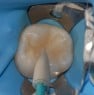Intensiv Unigloss Polisher Flacără (set cu 6 bucăți) [1]