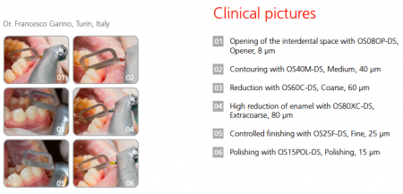KIT COMPLET (Protetică & Orto) - piesă Intensiv Swingle, fără lumină + 4 pile Intensiv Proxoshape + 6 fierăstraie Intensiv Ortho-Strips [11]