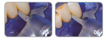 Pilă Intensiv Proxoshape PSC80 [2]