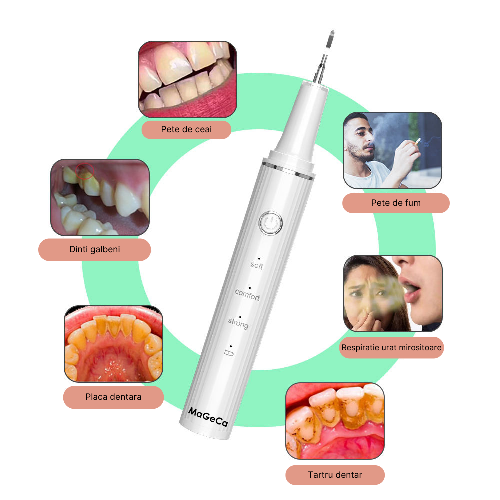 Dispozitiv pentru curatarea dintilor cu ultrasunete MaGeCa®, indeparteaza tartrul si petele, 3 trepte de viteza, rezistent la apa, incarcare USB Type-C, Alb [5]