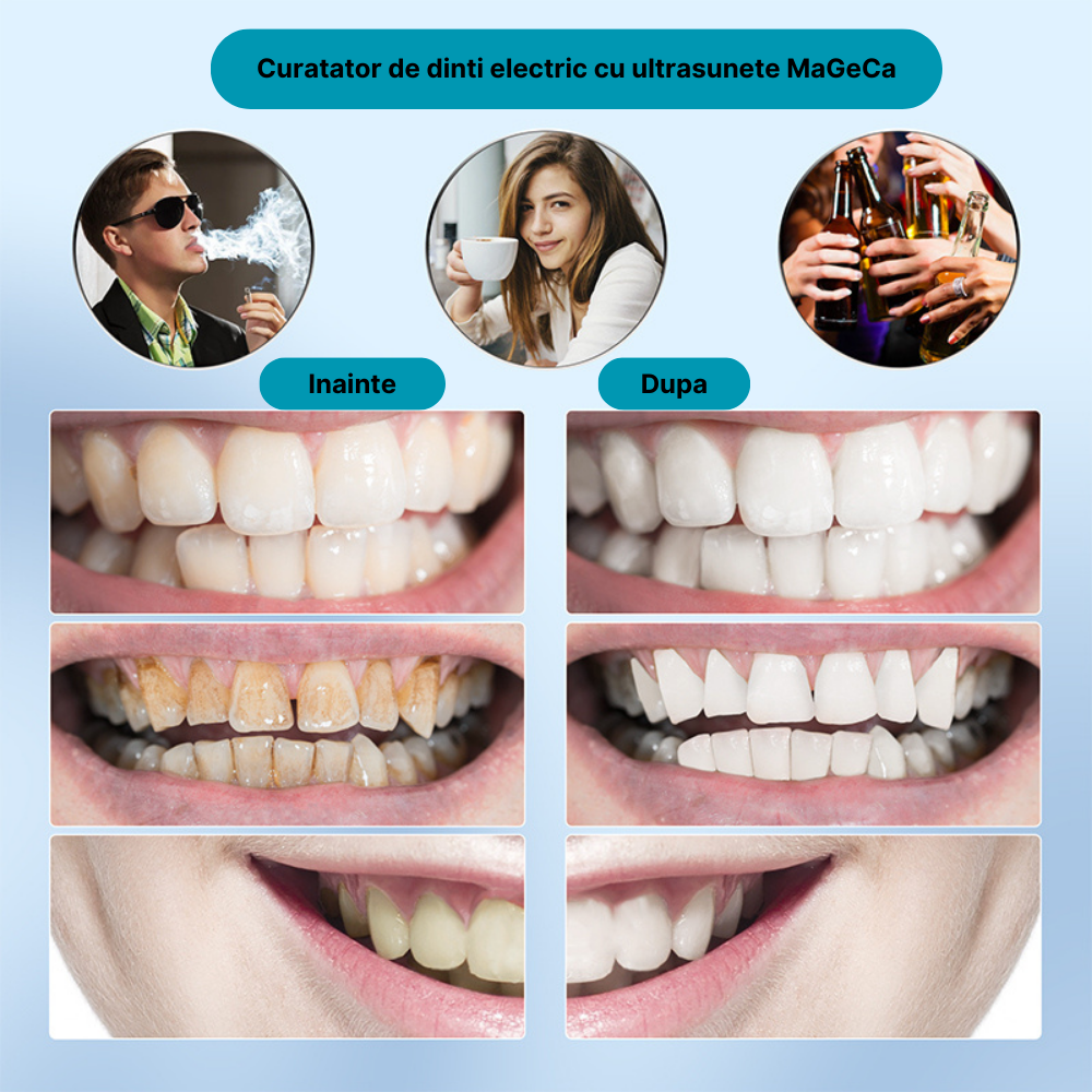 Dispozitiv pentru curatarea dintilor cu ultrasunete MaGeCa®, indeparteaza tartrul si petele, 3 trepte de viteza, rezistent la apa, incarcare USB Type-C, Alb [6]