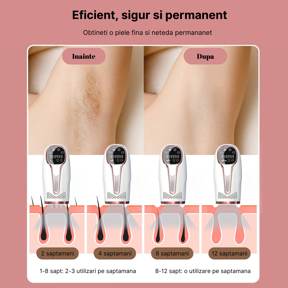 Epilator IPL MaGeCa®, dispozitiv de indepartare a parului cu laser pentru femei si barbati, 5 trepte de intensitate, 999.999 impulsuri pentru fata, brate, picioare, axila si inghinal, Epilare definiti [2]