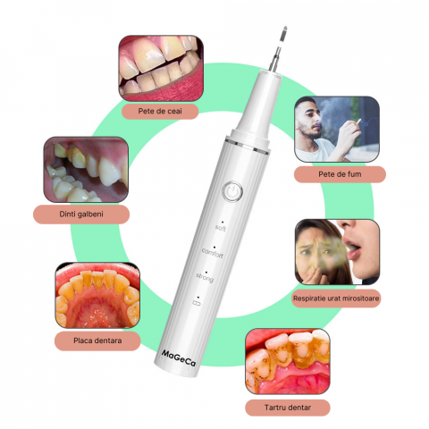 Dispozitiv pentru curatarea dintilor cu ultrasunete MaGeCa®, indeparteaza tartrul si petele, 3 trepte de viteza, rezistent la apa, incarcare USB Type-C, Alb [4]
